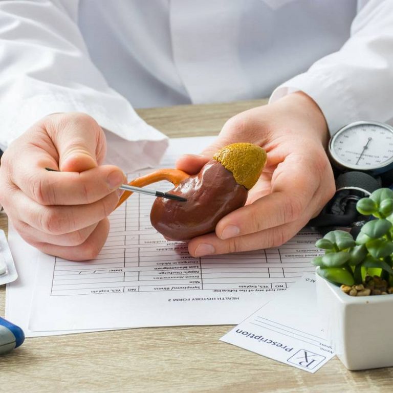 درمان کلیه پلی کیستیک بزرگسالان