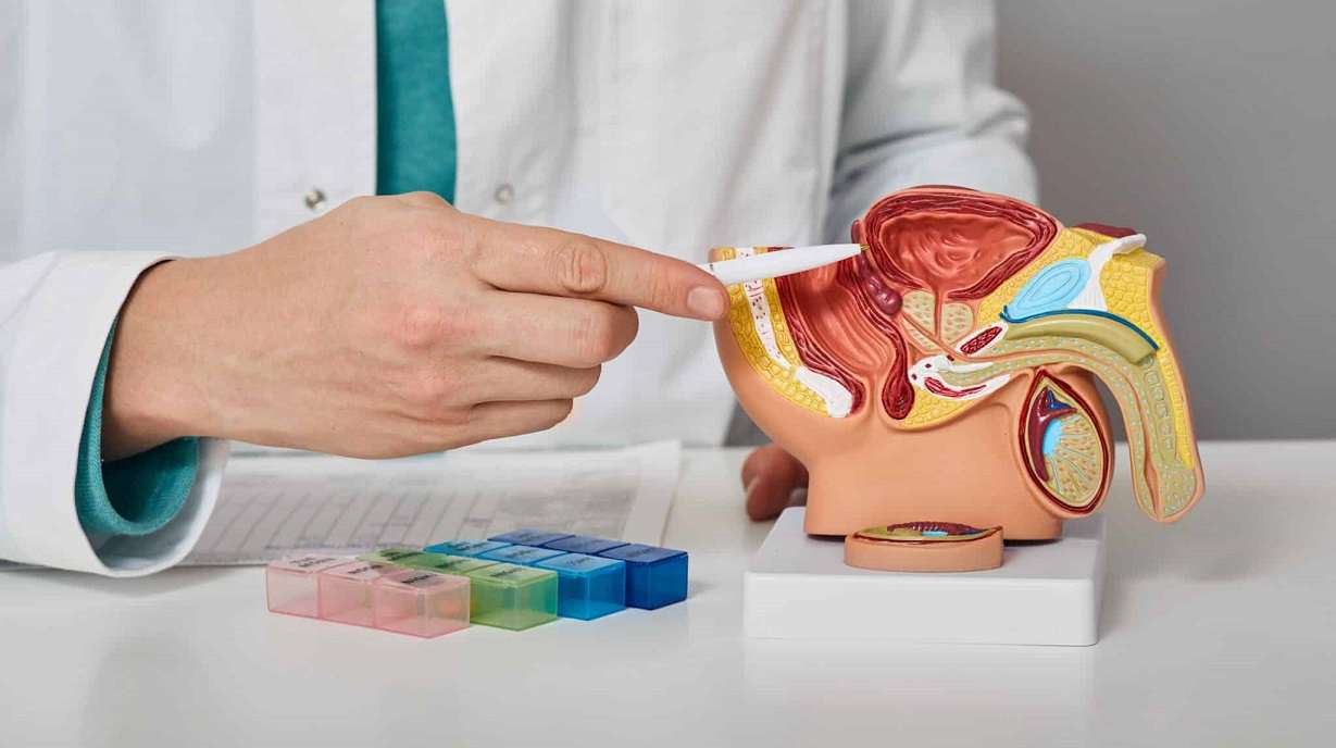 پزشک با مدل آناتومی، محل غده‌ی پروستات زیر مثانه را نشان می‌دهد