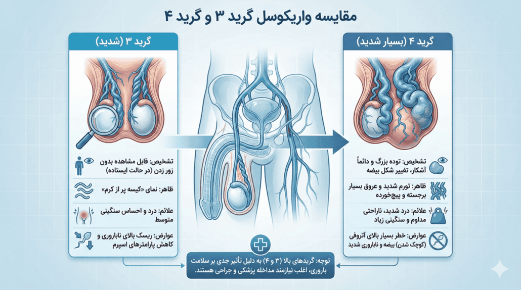 فرق واریکوسل گرید ۳ و ۴