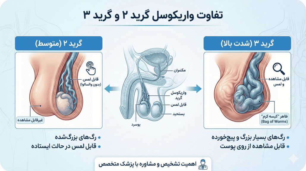 فرق واریکوسل گرید ۲ با ۳