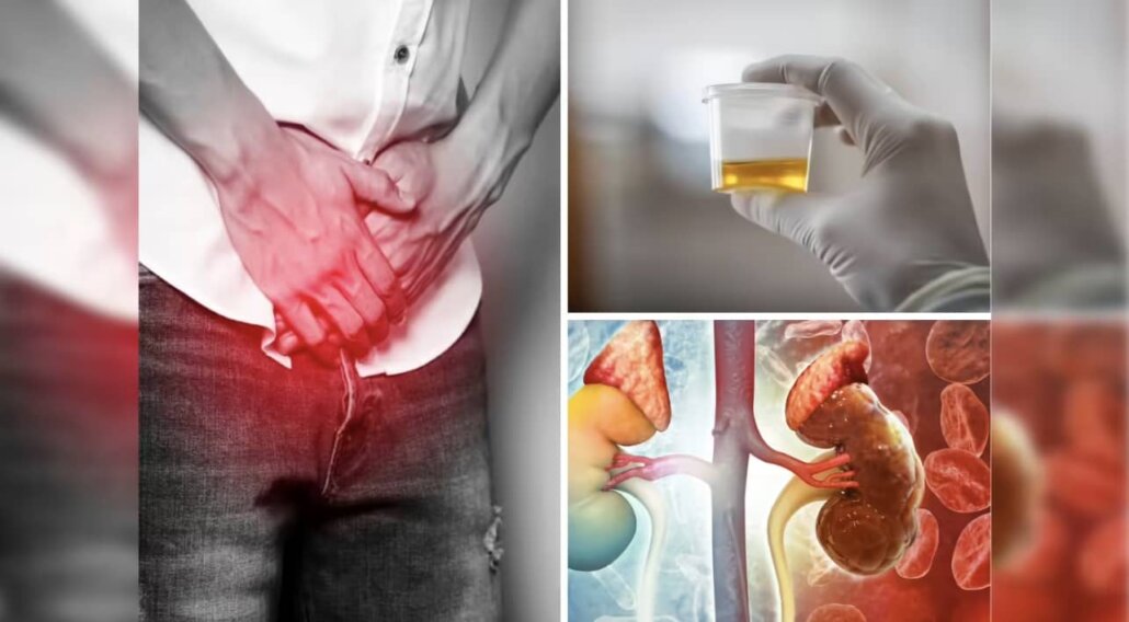 طول عمر بیماران سرطان مثانه