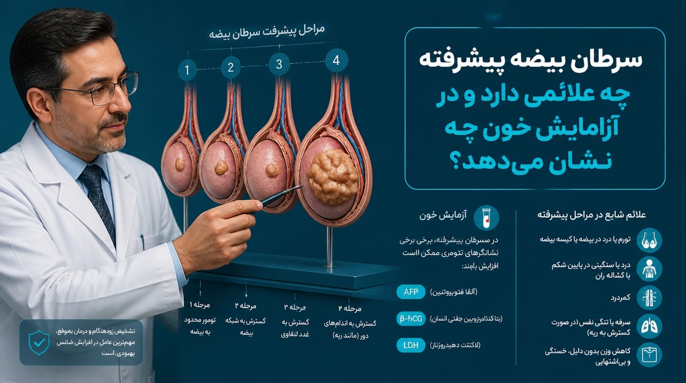 علائم سرطان بیضه پیشرفته