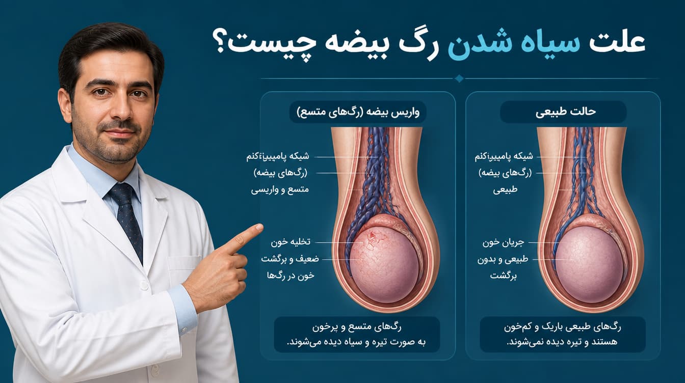 سیاه شدن رگ بیضه